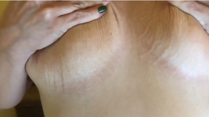 MILF Gives You Tour of Her Stretch Marks Nikki Sequoia